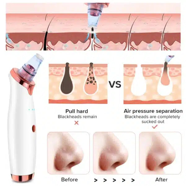 Electric Pore Vacuum Cleaner