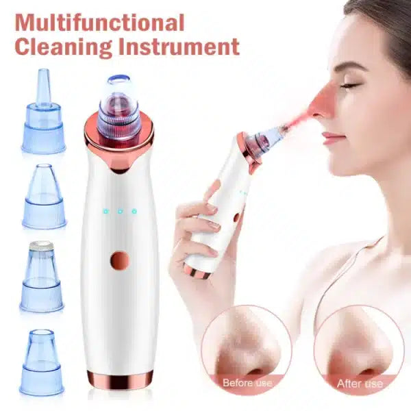 Electric Pore Vacuum Cleaner
